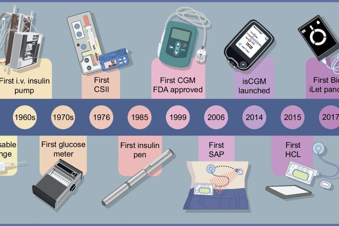 Η ιστορία της τεχνολογίας στη ρύθμιση του Διαβήτη